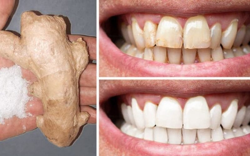 le gingembre et le sel permettent de blanchir les dents 1 1200x628 1 800x500 1